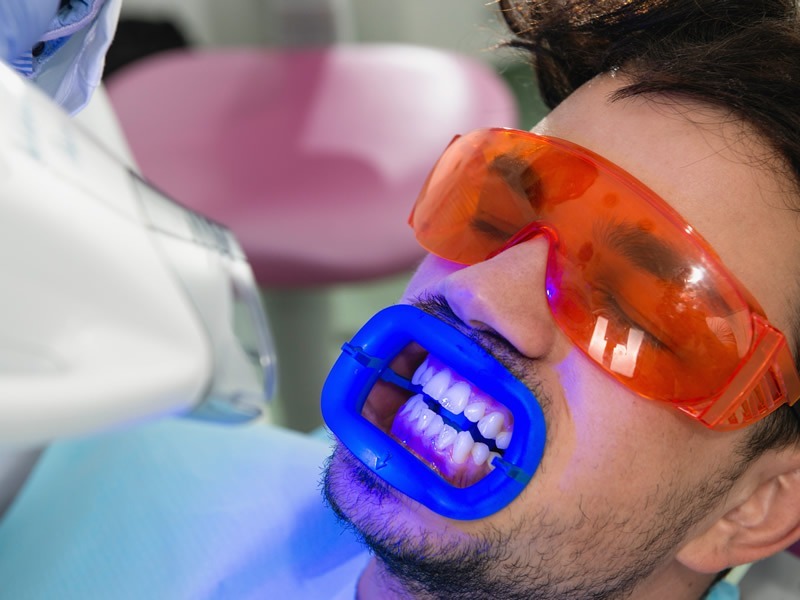 tooth-whitening3